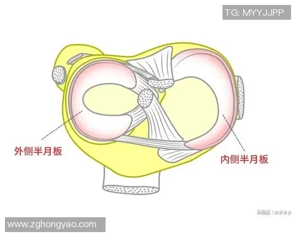 打篮球导致半月板损伤的原因及预防措施详解